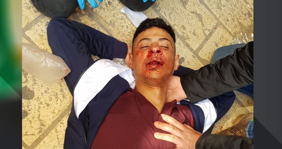 Palestinian badly injured in settlers’ attack