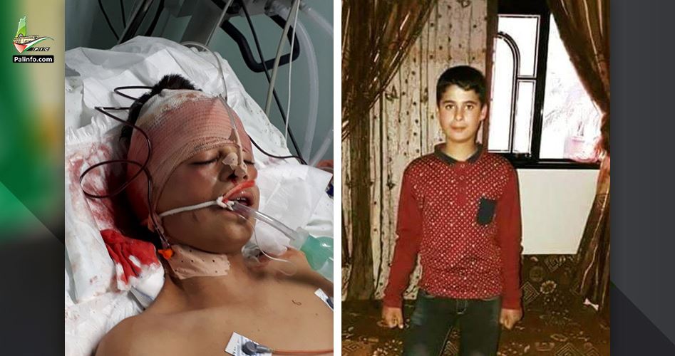Child succumbs to his wounds to be Gaza&#39;s 46th martyr