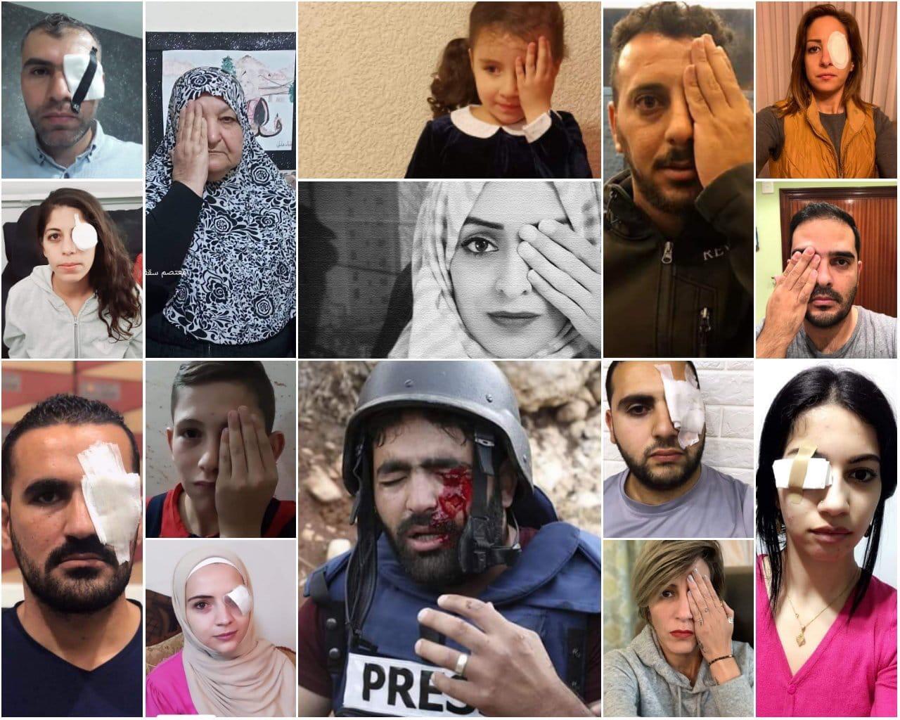 Activists, Journalists Launch Campaign In Support Of Injured Photojournalist